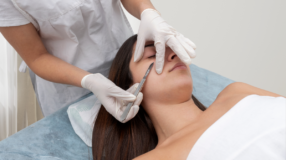 Dermaplaning: benefícios, indicações e dúvidas respondidas